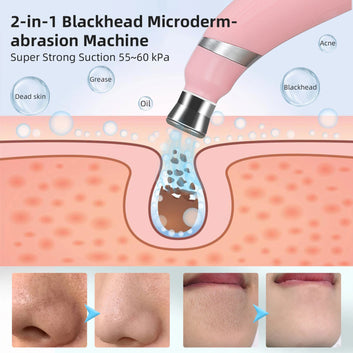 Portable Blackhead Remover Machine